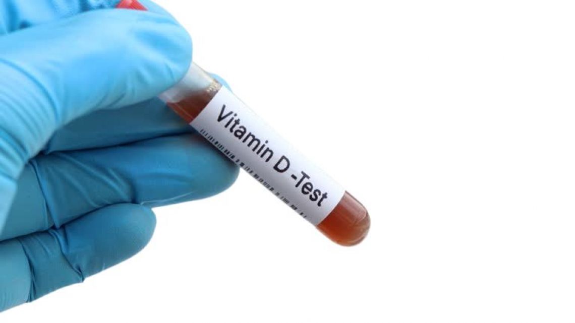 Esame Vitamina D